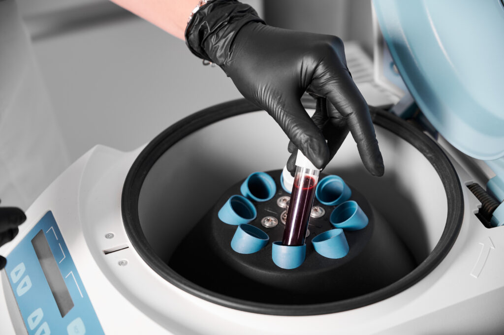 Close up of a laboratory centrifuge spinning research vials for cellular clearance analysis.Â